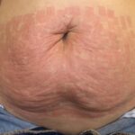 64dbdf18-11f8-4756-9c8b-c2c9c375a0a2